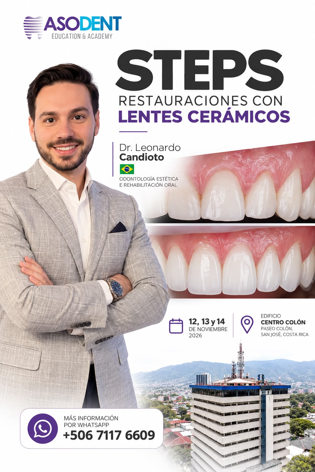 Curso STEPS de restauraciones con lentes cerámicos en ASODENT Education